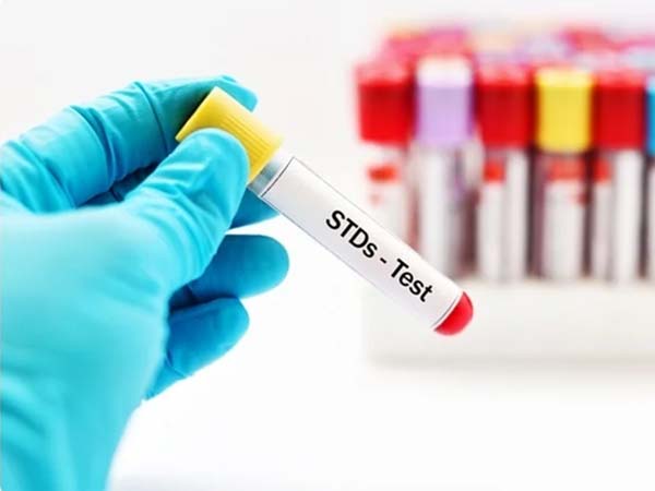 STDs Treatment in East Delhi